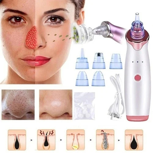 GlowSkin™ Portable Blackhead Remover