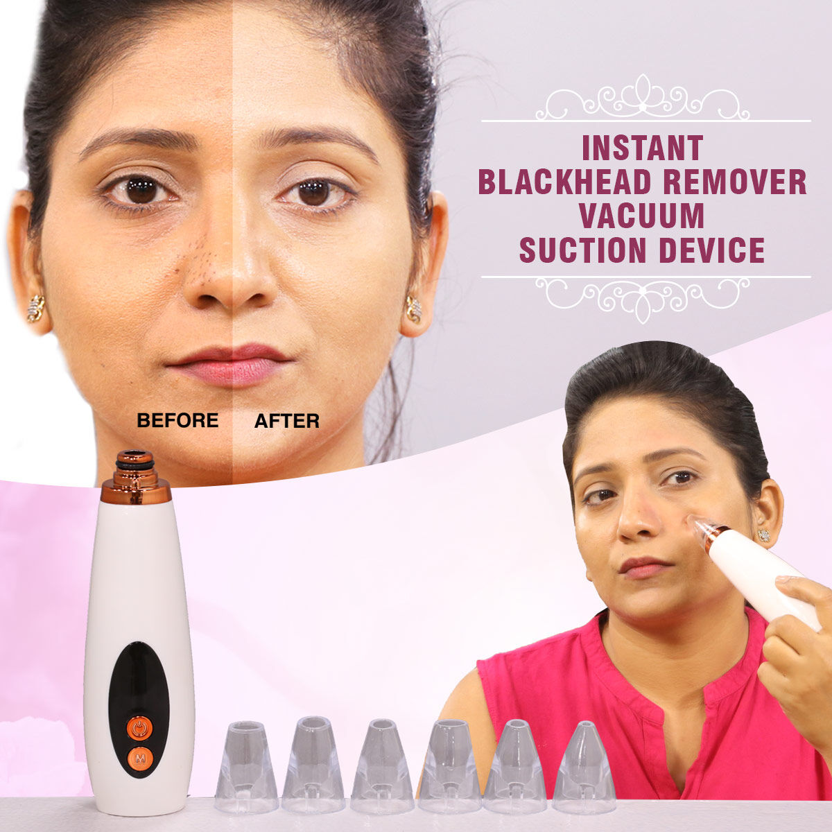 GlowSkin™ Portable Blackhead Remover